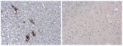 Human Matched Pair Tissue Array - Brain (Alzheimer's Disease + Normal). GTX49382
