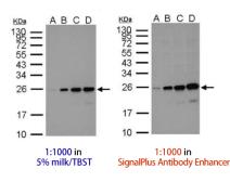 SignalPlus Antibody Enhancer. GTX49999