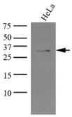 Anti-KCTD15 antibody [AT4C3] used in Western Blot (WB). GTX50002