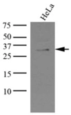Anti-KCTD15 antibody [AT4C3] used in Western Blot (WB). GTX50002