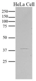 Anti-Maspin antibody [AT2N6] used in Western Blot (WB). GTX50010