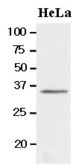 Anti-BRCC36 antibody [AT3B1] used in Western Blot (WB). GTX50015