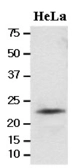 Anti-LITAF antibody [AT1F9] used in Western Blot (WB). GTX50019
