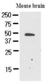 Anti-GAS7 antibody [AT4H8] used in Western Blot (WB). GTX50021