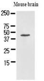 Anti-Homer1 antibody [AT1F3] used in Western Blot (WB). GTX50022