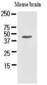 Anti-Homer1 antibody [AT1F3] used in Western Blot (WB). GTX50022