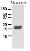 Anti-CRABP2 antibody [AT2E11] used in Western Blot (WB). GTX50029