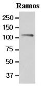 Anti-NFAT2 antibody [AT1C3] used in Western Blot (WB). GTX50030