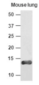 Anti-VAMP3 antibody [k2A2] used in Western Blot (WB). GTX50034