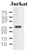 Anti-IL33 antibody [4E9] used in Western Blot (WB). GTX50047