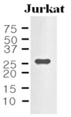 Anti-IL33 antibody [4E9] used in Western Blot (WB). GTX50047