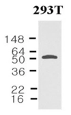 Anti-Visfatin antibody [4D5] used in Western Blot (WB). GTX50049