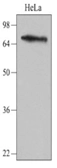 Anti-NSD3 antibody [2E9] used in Western Blot (WB). GTX50055