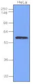 Anti-IRF3 antibody [3F10] used in Western Blot (WB). GTX50058