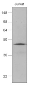 Anti-Hsp40 antibody [k1C7] used in Western Blot (WB). GTX50059