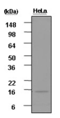 Anti-ISG15 antibody [3E5] used in Western Blot (WB). GTX50062