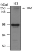 Anti-GRP94 antibody [2H3] used in Western Blot (WB). GTX50064