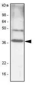 Anti-C/EBP beta antibody [47A1] used in Western Blot (WB). GTX50067