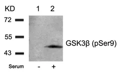 Anti-GSK3 beta (phospho Ser9) antibody used in Western Blot (WB). GTX50090