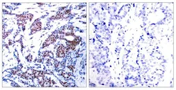 Anti-c-Jun (phospho Ser73) antibody used in IHC (Paraffin sections) (IHC-P). GTX50091