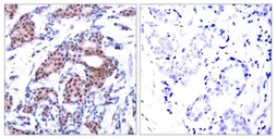 Anti-ELK1 (phospho Ser383) antibody used in IHC (Paraffin sections) (IHC-P). GTX50092
