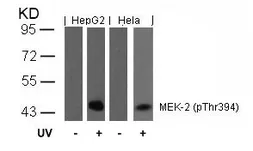 Anti-MEK2 (phospho Thr394) antibody used in Western Blot (WB). GTX50096