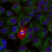 Anti-NFkB p65 (phospho Thr254) antibody used in Immunocytochemistry/ Immunofluorescence (ICC/IF). GTX50097