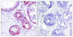 Anti-c-Jun (phospho Ser243) antibody used in IHC (Paraffin sections) (IHC-P). GTX50104