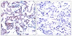 Anti-JunB (phospho Ser259) antibody used in IHC (Paraffin sections) (IHC-P). GTX50106