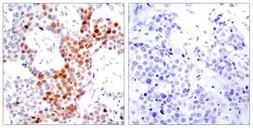 Anti-ATF2 (phospho Thr69) antibody used in IHC (Paraffin sections) (IHC-P). GTX50108