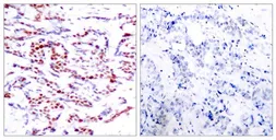 Anti-ATF2 (phospho Thr71) antibody used in IHC (Paraffin sections) (IHC-P). GTX50109