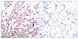 Anti-ATF2 (phospho Thr73) antibody used in IHC (Paraffin sections) (IHC-P). GTX50110