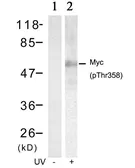 Anti-c-Myc (phospho Thr358) antibody used in Western Blot (WB). GTX50112