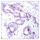Anti-c-Myc (phospho Ser373) antibody used in IHC (Paraffin sections) (IHC-P). GTX50113