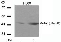 Anti-GATA1 (phospho Ser142) antibody used in Western Blot (WB). GTX50116