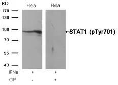 Anti-STAT1 (phospho Tyr701) antibody used in Western Blot (WB). GTX50118