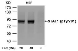 Anti-STAT1 (phospho Tyr701) antibody used in Western Blot (WB). GTX50118