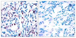 Anti-STAT3 (phospho Tyr705) antibody used in IHC (Paraffin sections) (IHC-P). GTX50119