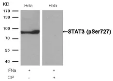 Anti-STAT3 (phospho Ser727) antibody used in Western Blot (WB). GTX50120
