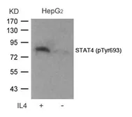 Anti-STAT4 (phospho Tyr693) antibody used in Western Blot (WB). GTX50121