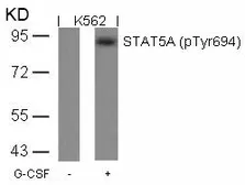 Anti-STAT5A (phospho Tyr694) antibody used in Western Blot (WB). GTX50122