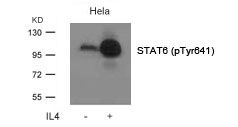 Anti-STAT6 (phospho Tyr641) antibody used in Western Blot (WB). GTX50124