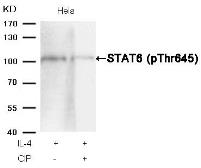 Anti-STAT6 (phospho Thr645) antibody used in Western Blot (WB). GTX50125