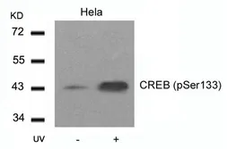 Anti-CREB (phospho Ser133) antibody used in Western Blot (WB). GTX50126