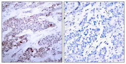 Anti-ATF4 (phospho Ser245) antibody used in IHC (Paraffin sections) (IHC-P). GTX50127