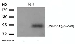Anti-NBS1 (phospho Ser343) antibody used in Western Blot (WB). GTX50131