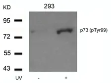 Anti-p73 (phospho Tyr99) antibody used in Western Blot (WB). GTX50132