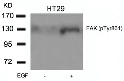 Anti-FAK (phospho Tyr861) antibody used in Western Blot (WB). GTX50133