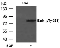 Anti-Ezrin (phospho Tyr354) antibody used in Western Blot (WB). GTX50135