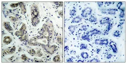 Anti-Bad (phospho Ser136) antibody used in IHC (Paraffin sections) (IHC-P). GTX50136